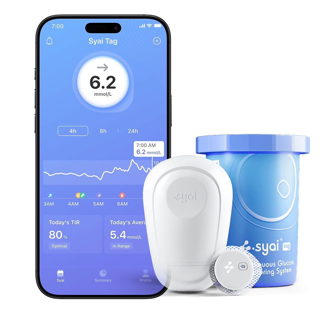 Syai — CGM последнего поколения